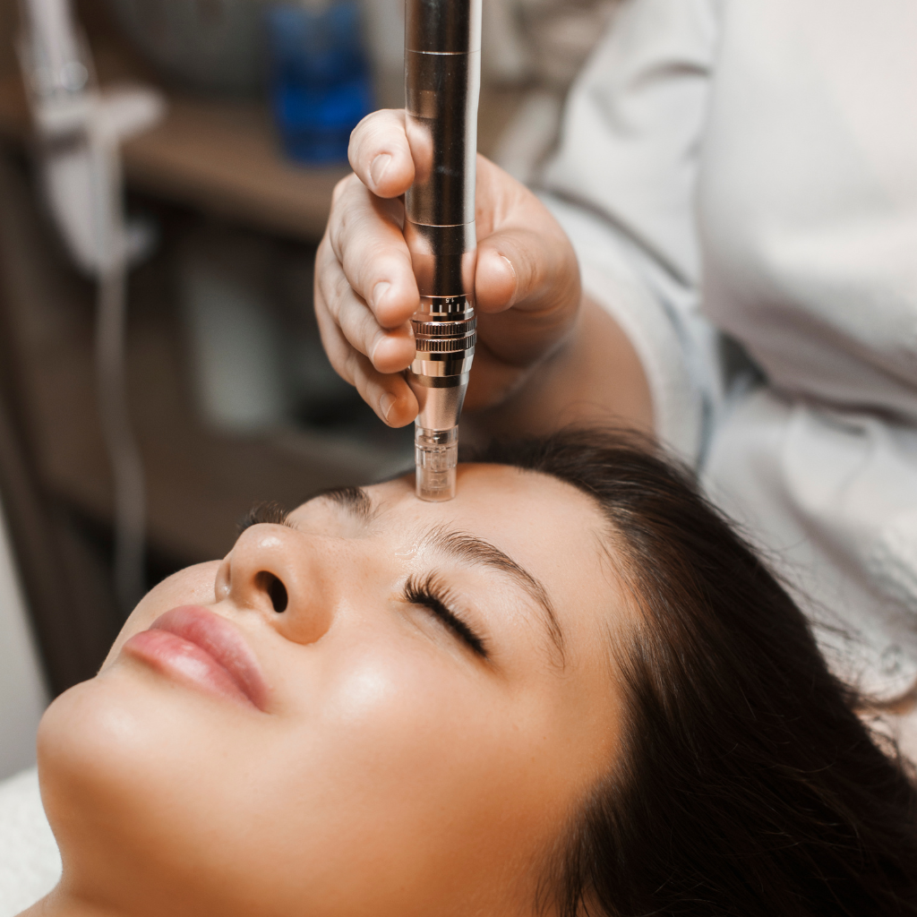 Microneedling skin treatment.