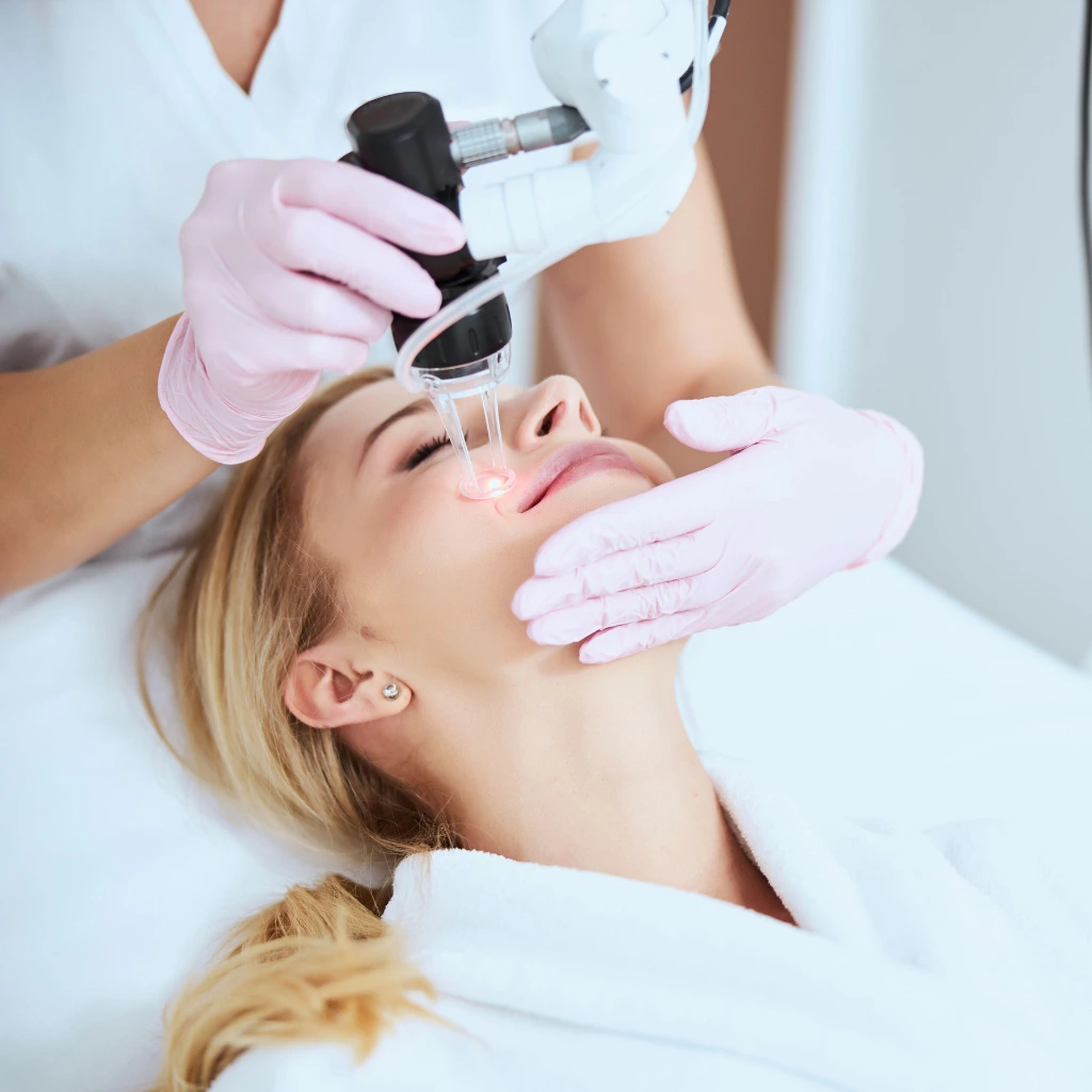Fractional CO2 Laser treatment to improve skin texture and reduce imperfections.