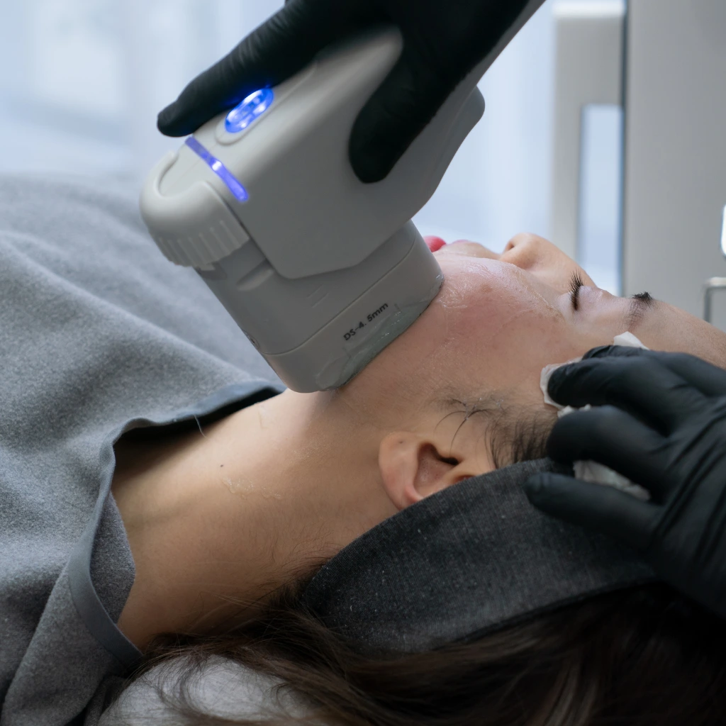 HIFU Anti-Aging treatment to lift, tighten, and rejuvenate the skin.