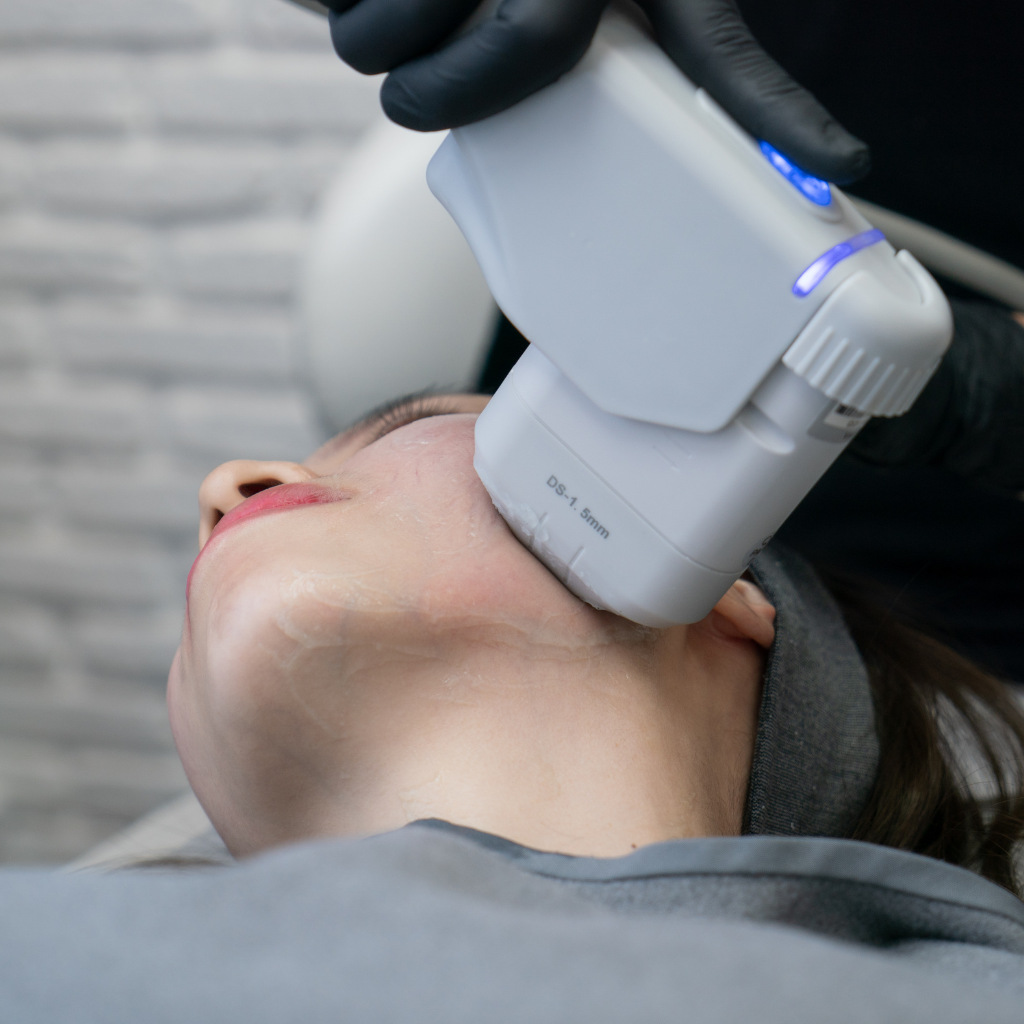 HIFU treatment to lift, tighten, and firm the skin.